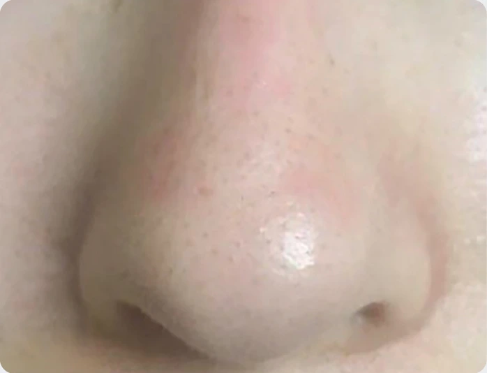 护理对比 1 — 使用后
