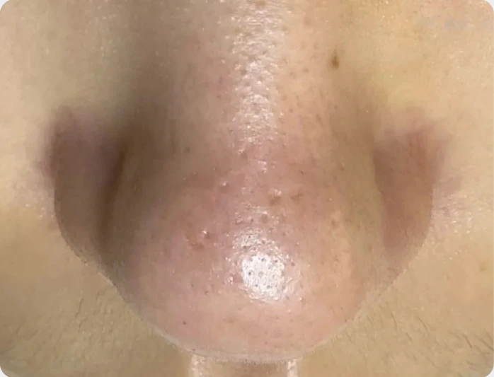 护理对比 2 — 使用后